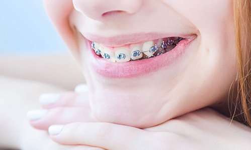 Ortodoncia y Ortopedia maxilar Convencional y Estética