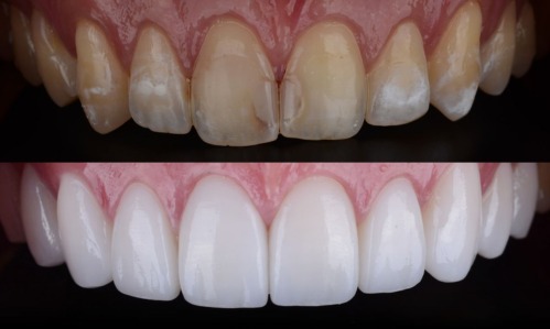 Estetica Dental y Restauracion Oral
