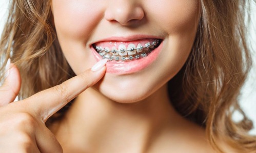 Ortodoncia y Ortopedia maxilar Convencional y Estetica